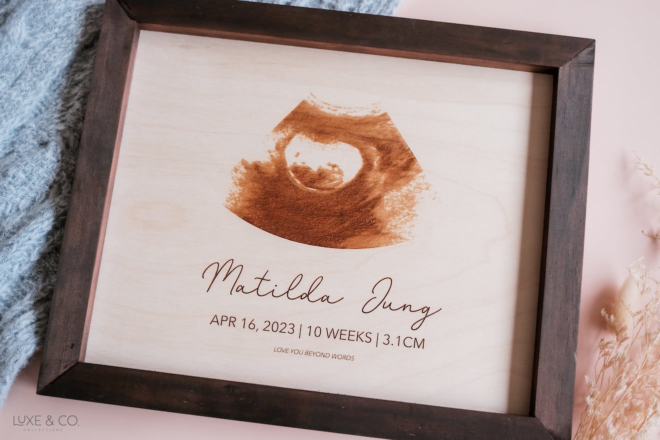 Persaonlised Ultrasound Frame